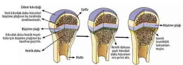 Kıkırdak Büyümesi Belirtileri ve Tedavisi