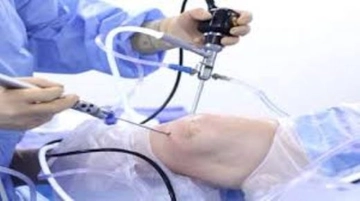 Diz Kıkırdak Nakli